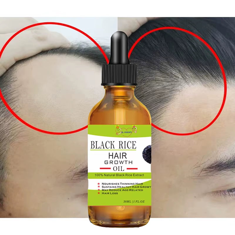 Hair Growth Products Fast Growing Hair Essential Oil Beauty Hair Care Prevent Hair Loss Liquid Scalp Treatment Hair Growth Serum