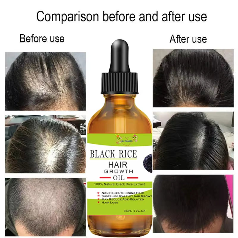 Hair Growth Products Fast Growing Hair Essential Oil Beauty Hair Care Prevent Hair Loss Liquid Scalp Treatment Hair Growth Serum